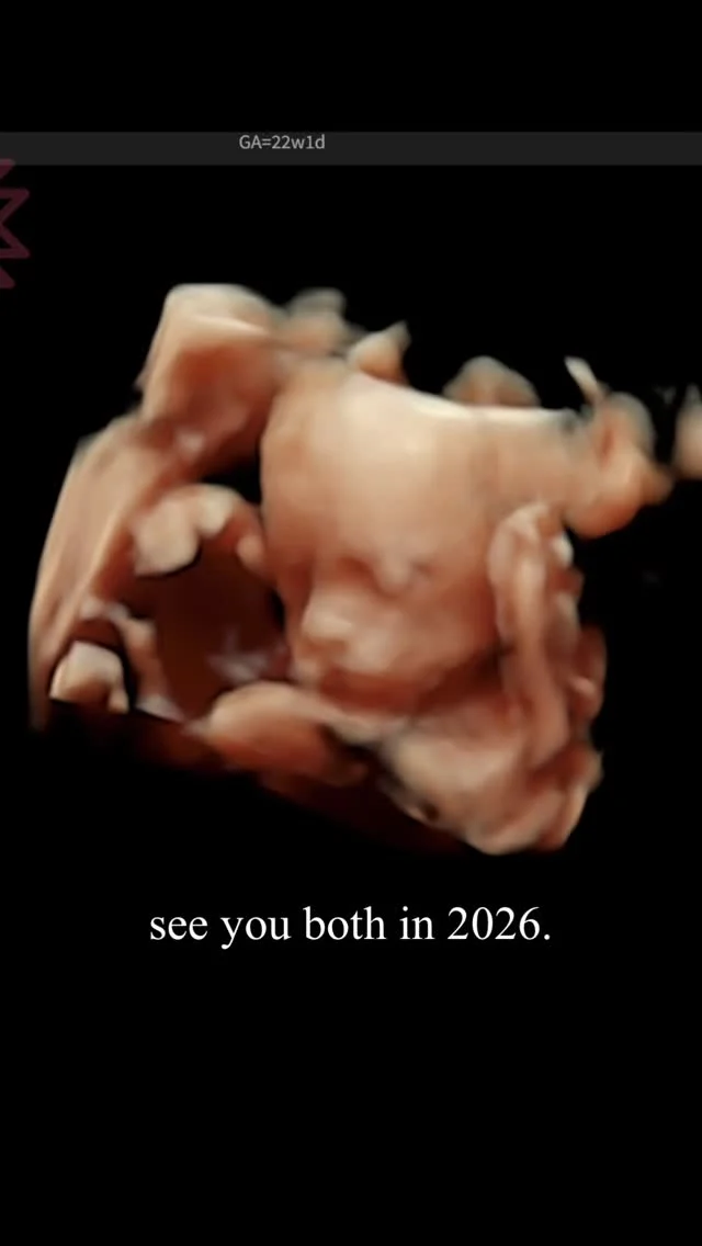 My 2025 recap🤍
1個身體3個心跳
基本上就是感受自己孕期身心變化的一年
但其實7月初才知道自己懷孕
似乎不記得2025上半年自己在幹麻😂

原本以為2025年會是平淡的一年
沒想到突如其來的雙寶改變了我的人生
我想2026年後的人生應該就是充斥著小孩👶🏻👶🏻

曾經想過自己懷孕
但還真的從沒想過自己會懷雙胞胎
到現在已經懷孕32週+了
現在想起來還是很不真實…
雖然每一次的胎動是那麼真實強勁…
雙寶歷經重重產檢關卡依舊努力在肚子裡長大
現在就是等跟妳們見面啦！
我們2026年見👋

#混血兒 #混血兒寶寶 #台法混血 #雙胞胎 #同卵雙胞胎