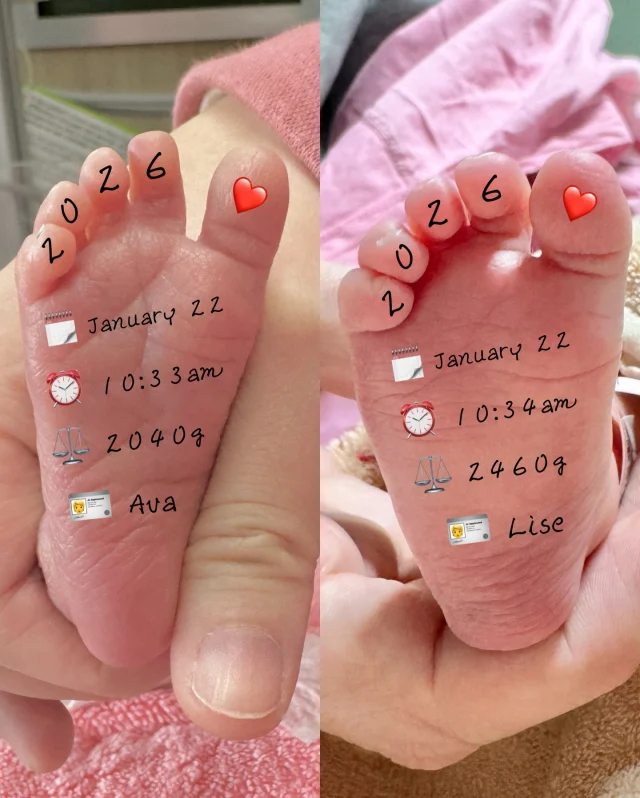 姐姐Ava 、妹妹Lise🇹🇼🇫🇷
Bonjour初次和大家見面👋

先露個腳丫裝神秘一下😎
雙寶出生後都有超過2000克🥹
姐姐Ava比較輕所以目前還在保溫箱裡
妹妹Lise已經在嬰兒室每天都可以母嬰同室
姐妹倆出生時哭聲都超大聲！
同卵雙胞胎一出生就被分開🥹
但應該不用太久她們就可以團聚了！
兩位在肚子裡面爭空間爭地盤爭養分那麼久了
現在先讓她們消停一下也好🤣

猜猜看倆姐妹的比較像我還是西蒙呢❓

#混血兒 #台法混血 #雙胞胎混血兒 #雙胞胎 #雙胞胎姐妹